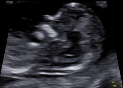 Protokoly pro FMF certifikaci & audit