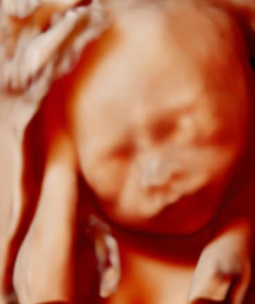 Ultrazvuková vyšetření